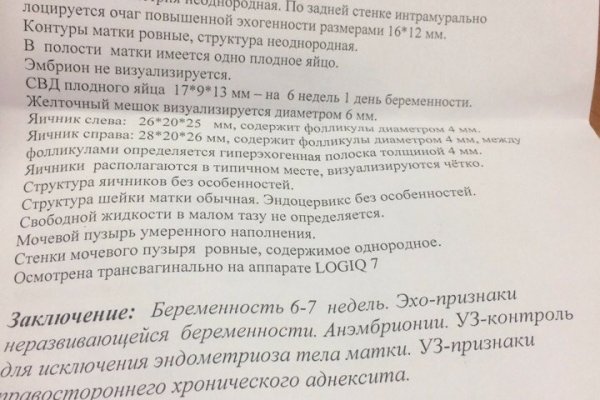 Сайт krn
